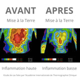 Tige métallique de Mise à la Terre Earthing